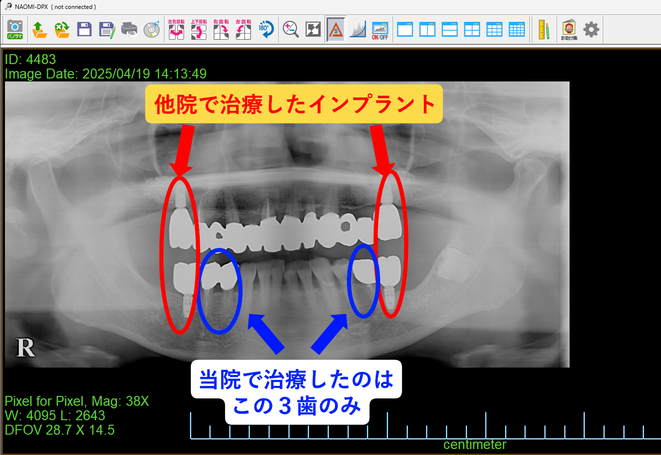保険メンテナンス例