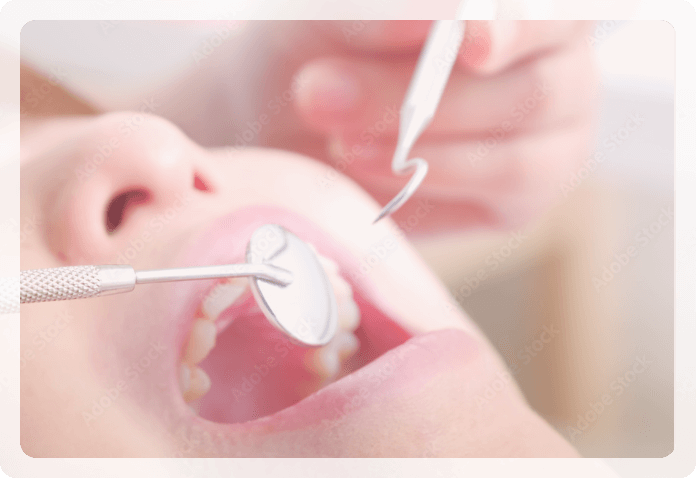 定期的な歯石除去で歯は守れる⁈