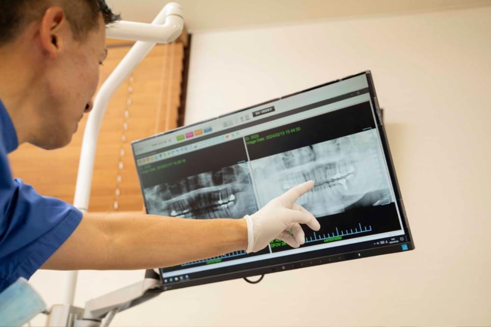 診断と治療計画