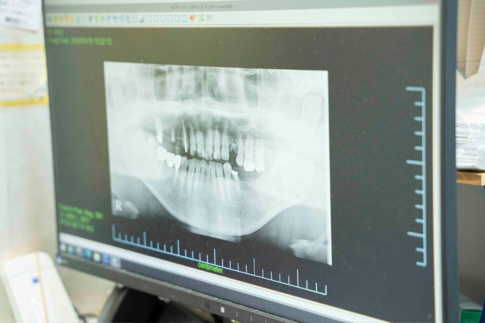歯周病は死に至る病気（全身疾患）と密接な関係にあります