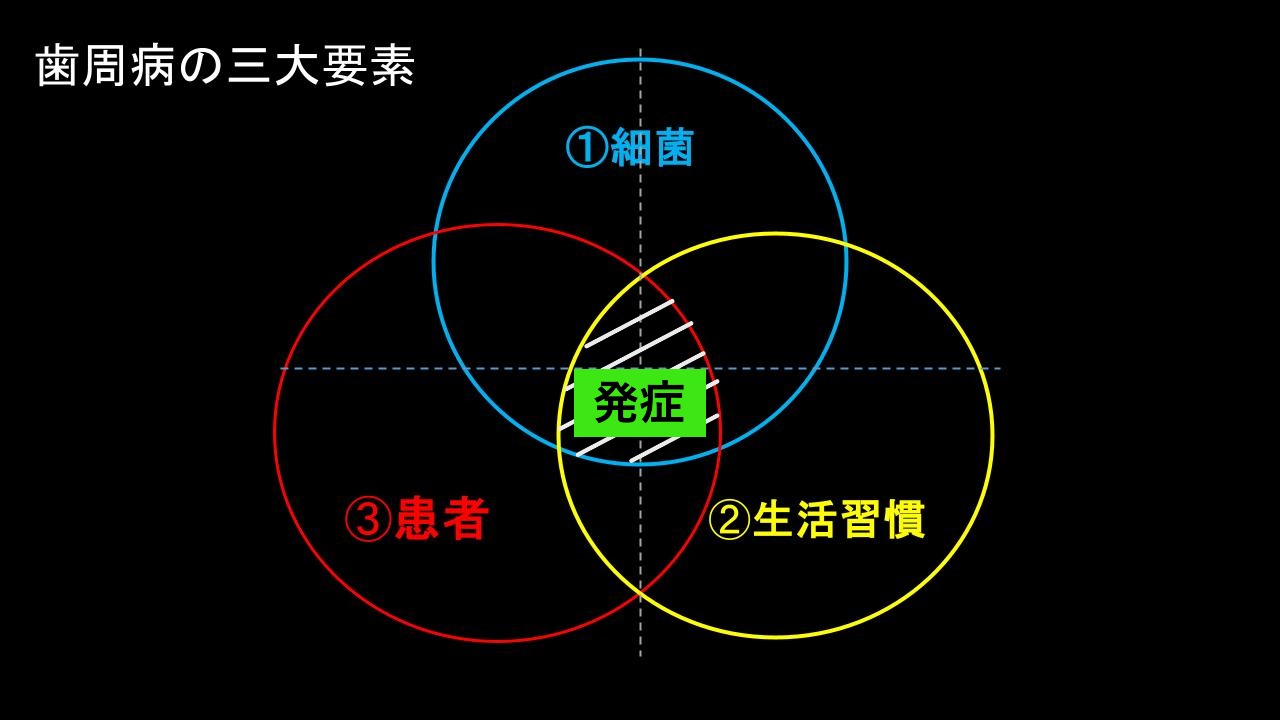 歯周病について