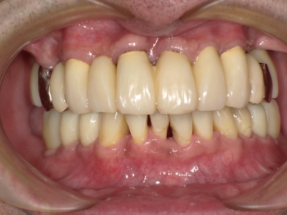 保険メンテナンス例